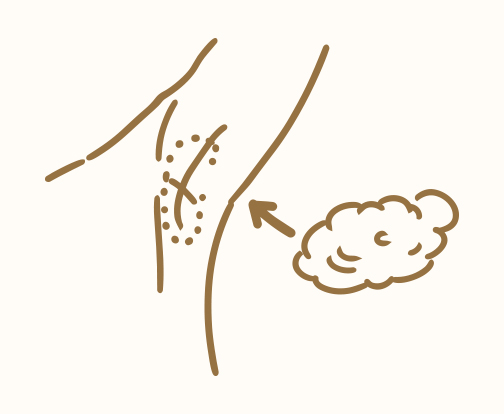 手術（保険診療）