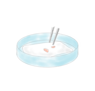 治療方法