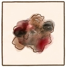 皮膚がん