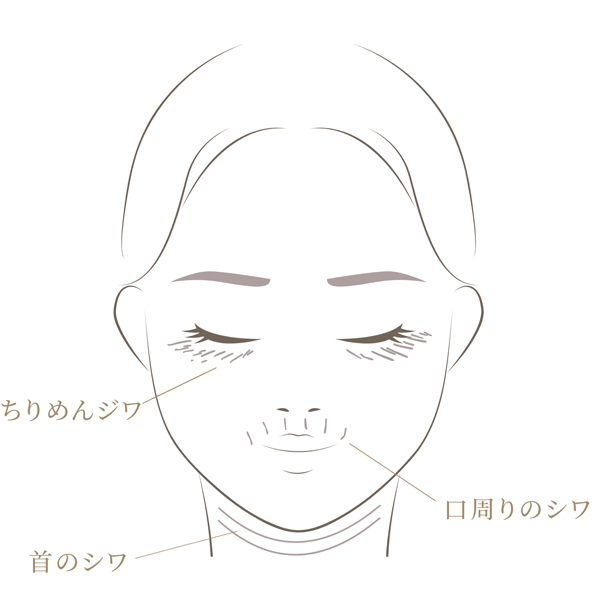 コラーゲン低下によるシワ